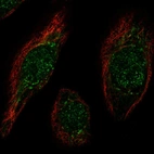 Immunofluorescent staining of human cell line hTCEpi shows localization to nucleus & the Golgi apparatus.