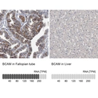 Anti-BCAM Antibody
