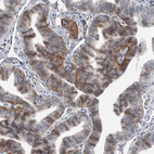 Immunohistochemical staining of human Fallopian tube shows strong membranous positivity in glandular cells.