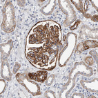 Anti-BCAM Antibody