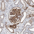 Immunohistochemical staining of human Kidney shows strong membranous positivity in cells in glomeruli and cells in distal tubules.