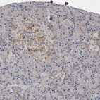 Immunohistochemical staining of human Pancreas shows moderate membranous positivity in islets of Langerhans.