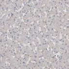 Immunohistochemical staining of human Liver shows very weak membranous positivity in hepatocytes.