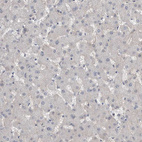 Anti-BCAM Antibody