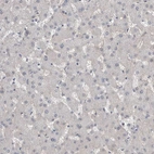 Immunohistochemical staining of human Liver shows very weak membranous positivity in hepatocytes.