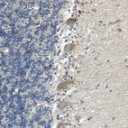 Immunohistochemical staining of human cerebellum shows moderate to strong endosomal positivity in Purkinje cells.