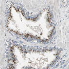 Immunohistochemical staining of human prostate shows moderate to strong endosomal positivity in glandular cells.
