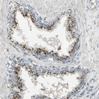 Immunohistochemical staining of human prostate shows moderate to strong endosomal positivity in glandular cells.
