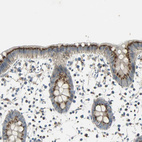 Immunohistochemical staining of human colon shows moderate to strong endosomal positivity in glandular cells.