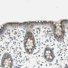 Anti-TM9SF2 Antibody