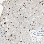 Anti-ADAMTS5 Antibody