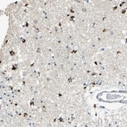 Anti-ADAMTS5 Antibody