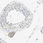Immunohistochemical staining of human testis shows moderate cytoplasmic positivity in Leydig cells.