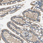 Immunohistochemical staining of human small intestine shows strong cytoplasmic-membranous positivity in glandular cells.