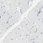 Immunohistochemical staining of human skeletal muscle shows negative positivity in myocytes as expected.