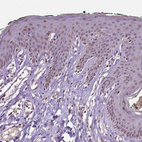 Immunohistochemical staining of human skin shows moderate nuclear positivity in squamous epithelial cells.