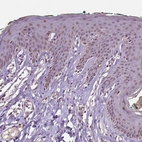 Immunohistochemical staining of human skin shows moderate nuclear positivity in squamous epithelial cells.