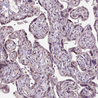 Immunohistochemical staining of human placenta shows weak nuclear positivity in trophoblastic cells.