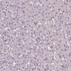 Immunohistochemical staining of human liver shows no positivity in hepatocytes as expected.