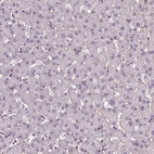 Immunohistochemical staining of human liver shows no positivity in hepatocytes as expected.
