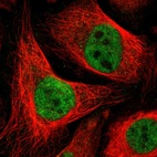 Immunofluorescent staining of human cell line U-2 OS shows localization to nucleus.