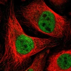 Immunofluorescent staining of human cell line U-2 OS shows localization to nucleus.