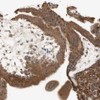 Immunohistochemical staining of human placenta shows strong cytoplasmic-membranous positivity in trophoblastic cells.