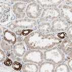Immunohistochemical staining of human kidney shows moderate cytoplasmic positivity in cells in tubules and endothelial cells.