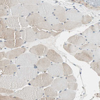 Immunohistochemical staining of human skeletal muscle shows negative positivity in myocytes.