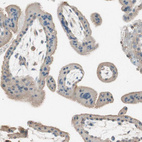 Anti-ITGBL1 Antibody