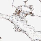 Immunohistochemical staining of human lung shows strong positivity in macrophages.