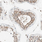 Immunohistochemical staining of human testis shows moderate positivity in cells in seminiferous ducts.