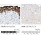 Anti-HPGD Antibody