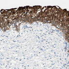 Immunohistochemical staining of human urinary bladder shows strong cytoplasmic positivity in urothelial cells.