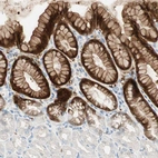Immunohistochemical staining of human stomach shows strong cytoplasmic positivity in glandular cells.