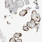 Immunohistochemical staining of human placenta shows moderate cytoplasmic positivity in trophoblastic cells.