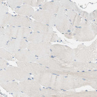 Immunohistochemical staining of human skeletal muscle shows no positivity in myocytes as expected.