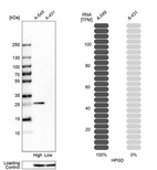 Anti-HPGD Antibody