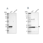Western blot analysis using Anti-HPGD antibody HPA005679 (A) shows similar pattern to independent antibody HPA004919 (B).