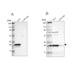Western blot analysis using Anti-HPGD antibody HPA005679 (A) shows similar pattern to independent antibody HPA004919 (B).