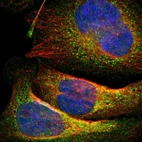 Immunofluorescent staining of human cell line U-2 OS shows localization to cytosol.