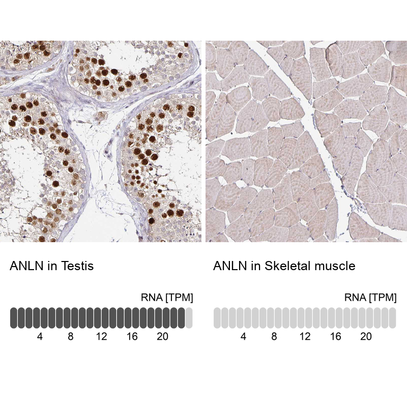Anti-ANLN Antibody