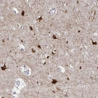 Immunohistochemical staining of human cerebral cortex shows strong nuclear and cytoplasmic positivity in neurons.