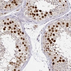 Immunohistochemical staining of human testis shows strong nuclear positivity in cells in seminiferous ducts.