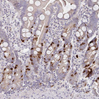 Immunohistochemical staining of human small intestine shows strong nuclear positivity in endocrine glandular cells.