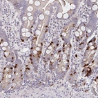 Immunohistochemical staining of human small intestine shows strong nuclear positivity in endocrine glandular cells.