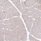 Immunohistochemical staining of human skeletal muscle shows no positivity in myocytes as expected.