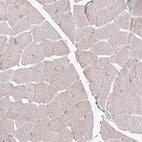 Immunohistochemical staining of human skeletal muscle shows no positivity in myocytes as expected.