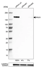Western blot analysis in U-251MG cells transfected with control siRNA, target specific siRNA probe #1 and #2, using Anti-ANLN antibody. Remaining relative intensity is presented. Loading control: Anti-GAPDH.