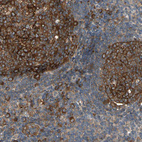 Anti-RIOK2 Antibody